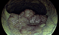 上部消化管内視鏡検査(胃カメラ)モニター画像2